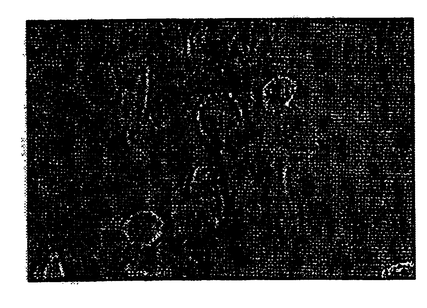 Pharmaceutical compositions comprising cyclic glycerophosphates and analogs thereof for promoting neural cell differentiation