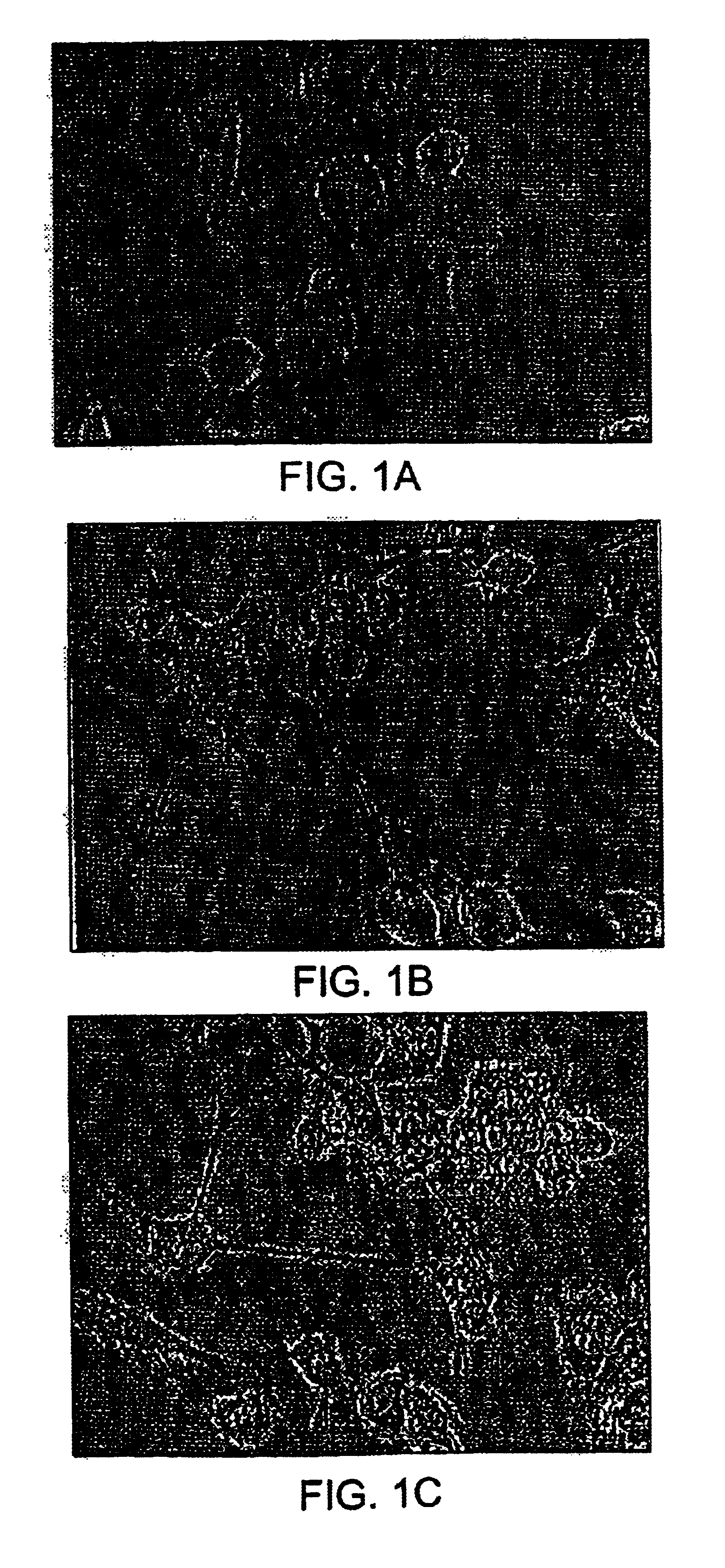Pharmaceutical compositions comprising cyclic glycerophosphates and analogs thereof for promoting neural cell differentiation