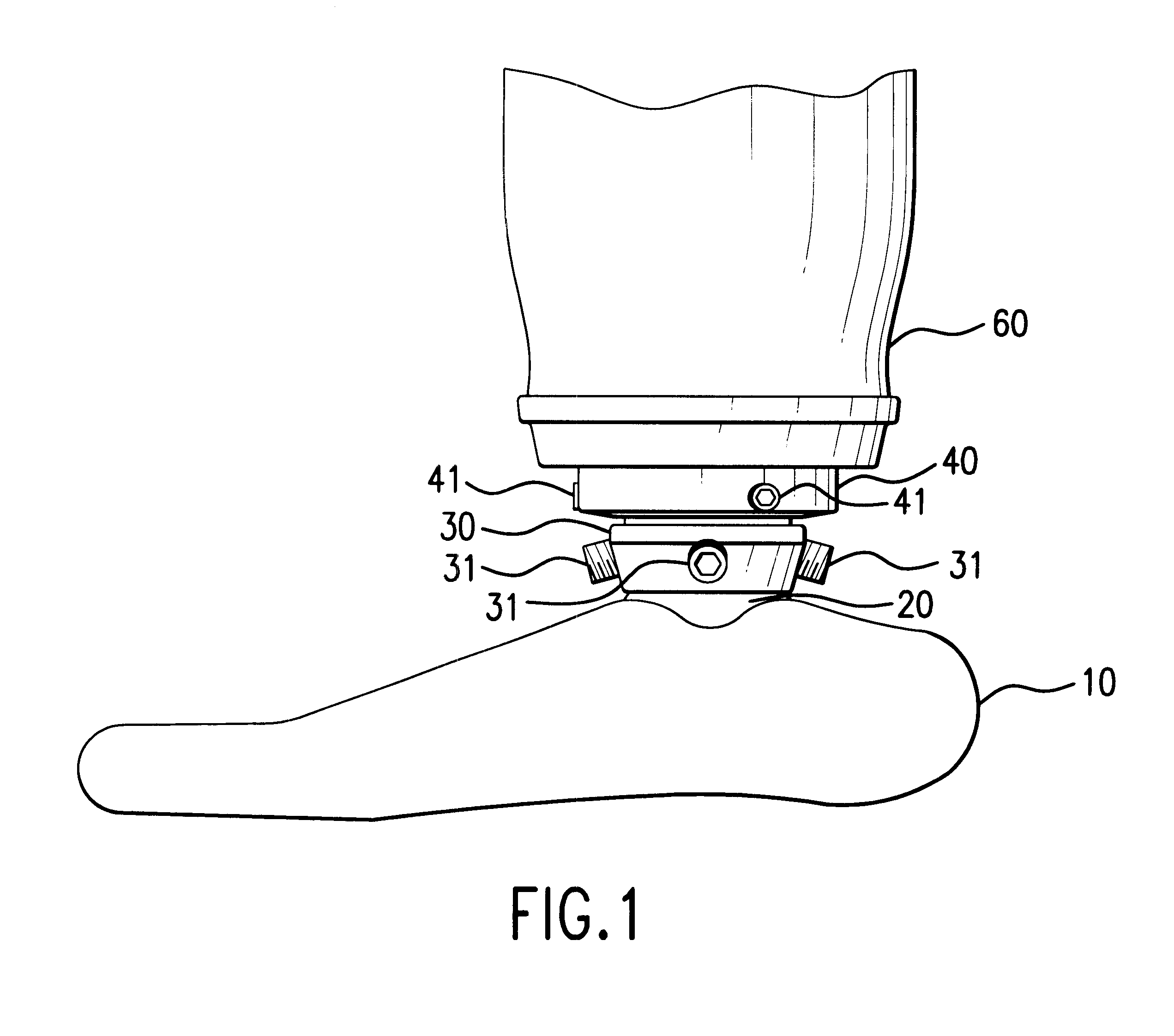 Locking device for a prothesis
