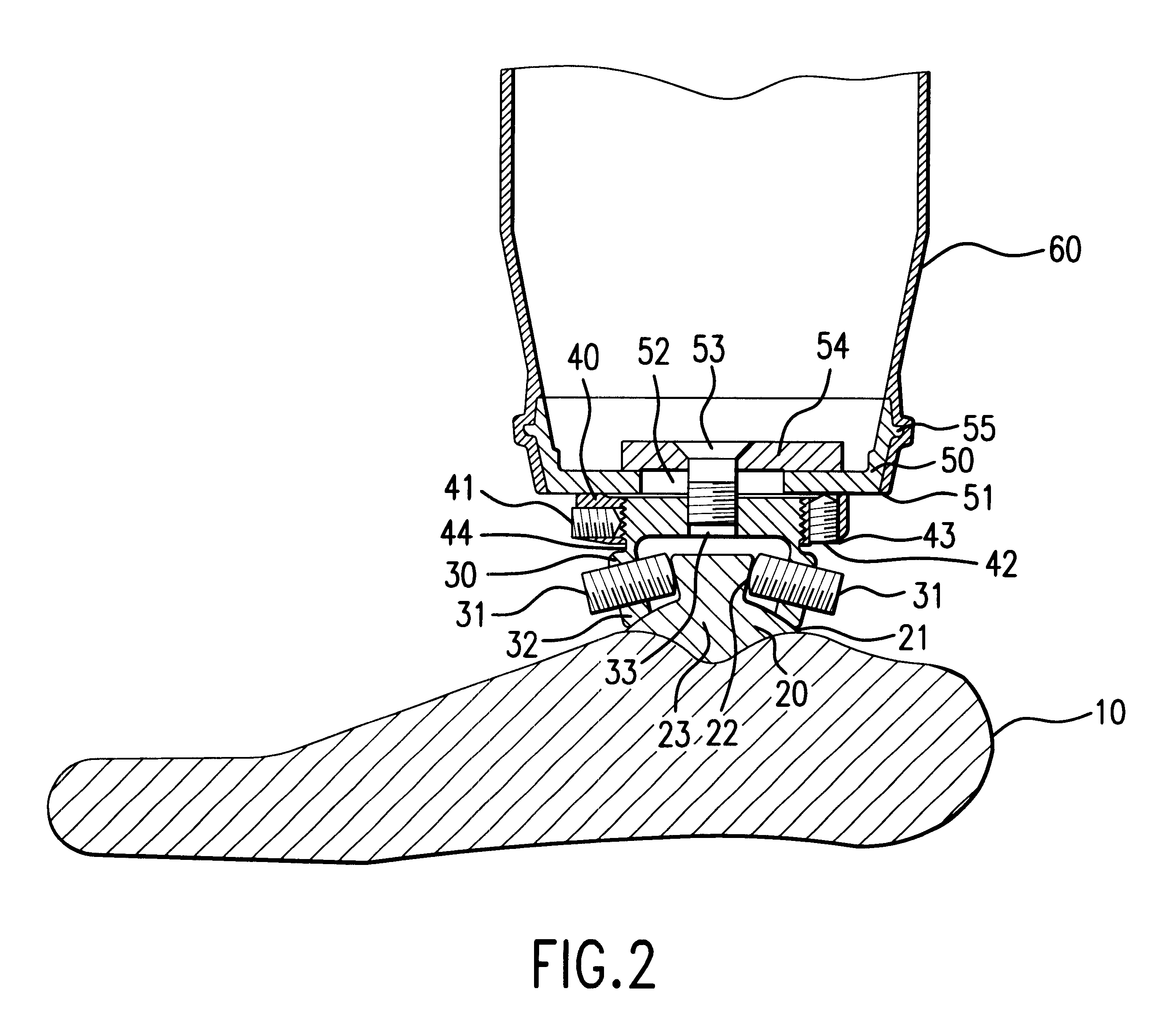 Locking device for a prothesis