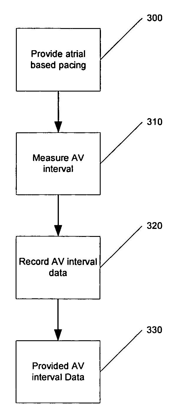 System and method of using AV conduction timing