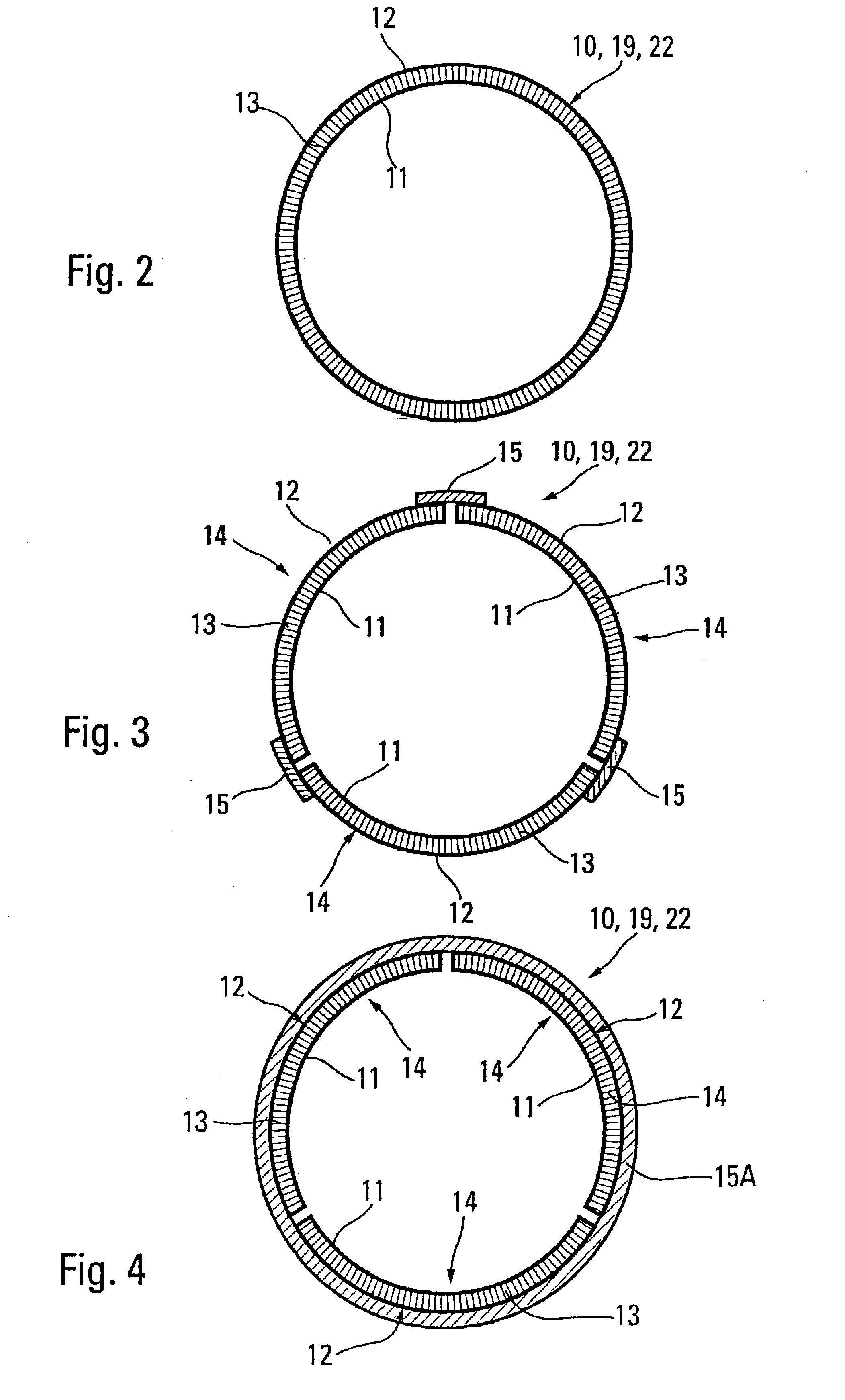 Aircraft engine pod with acoustic attenuation