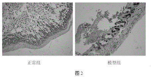 Applications of stilbene glucoside in preparation of medicament for improving intestinal mucosal barrier function