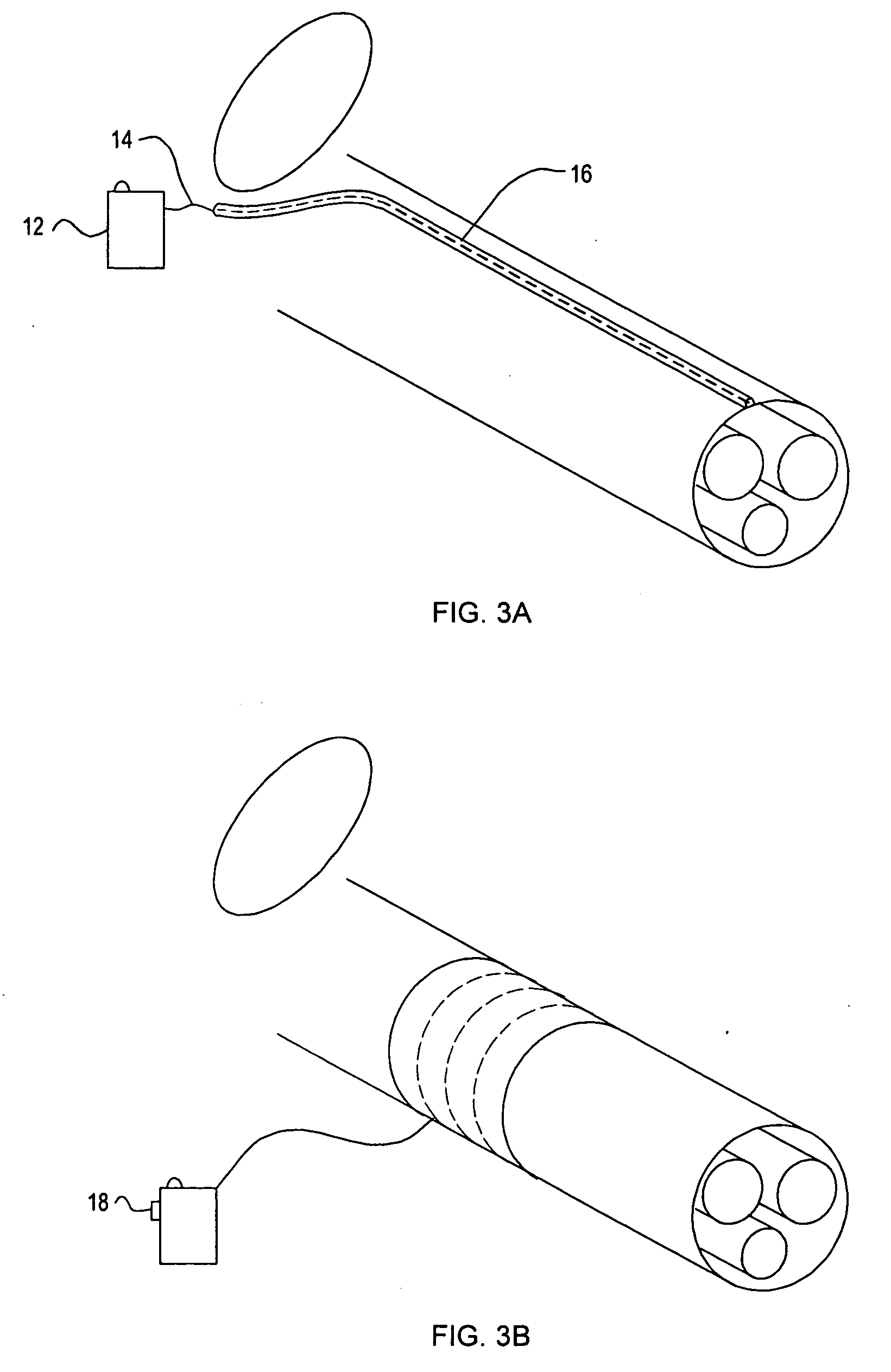 Implantable device and method for managing erectile dysfunction