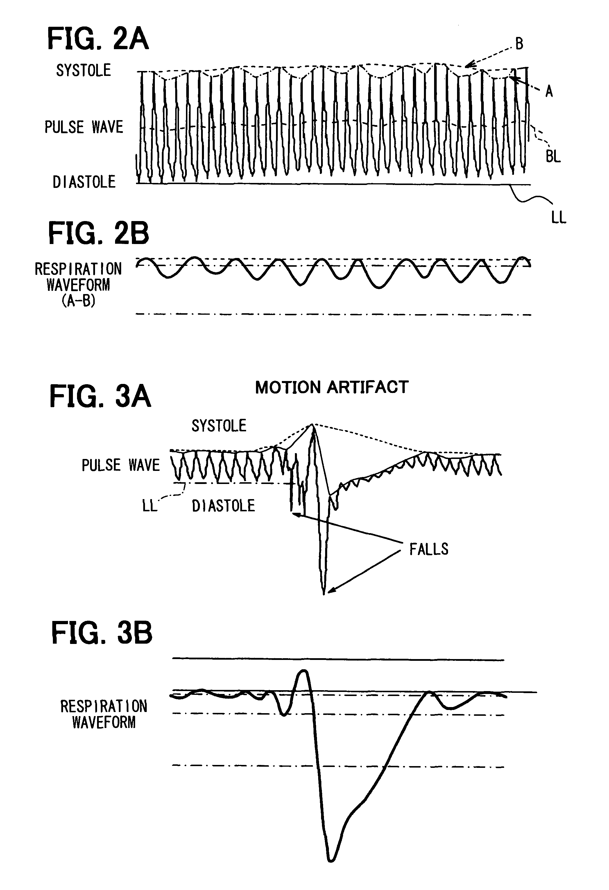 Apparatus for detecting vital functions, control unit and pulse wave sensor