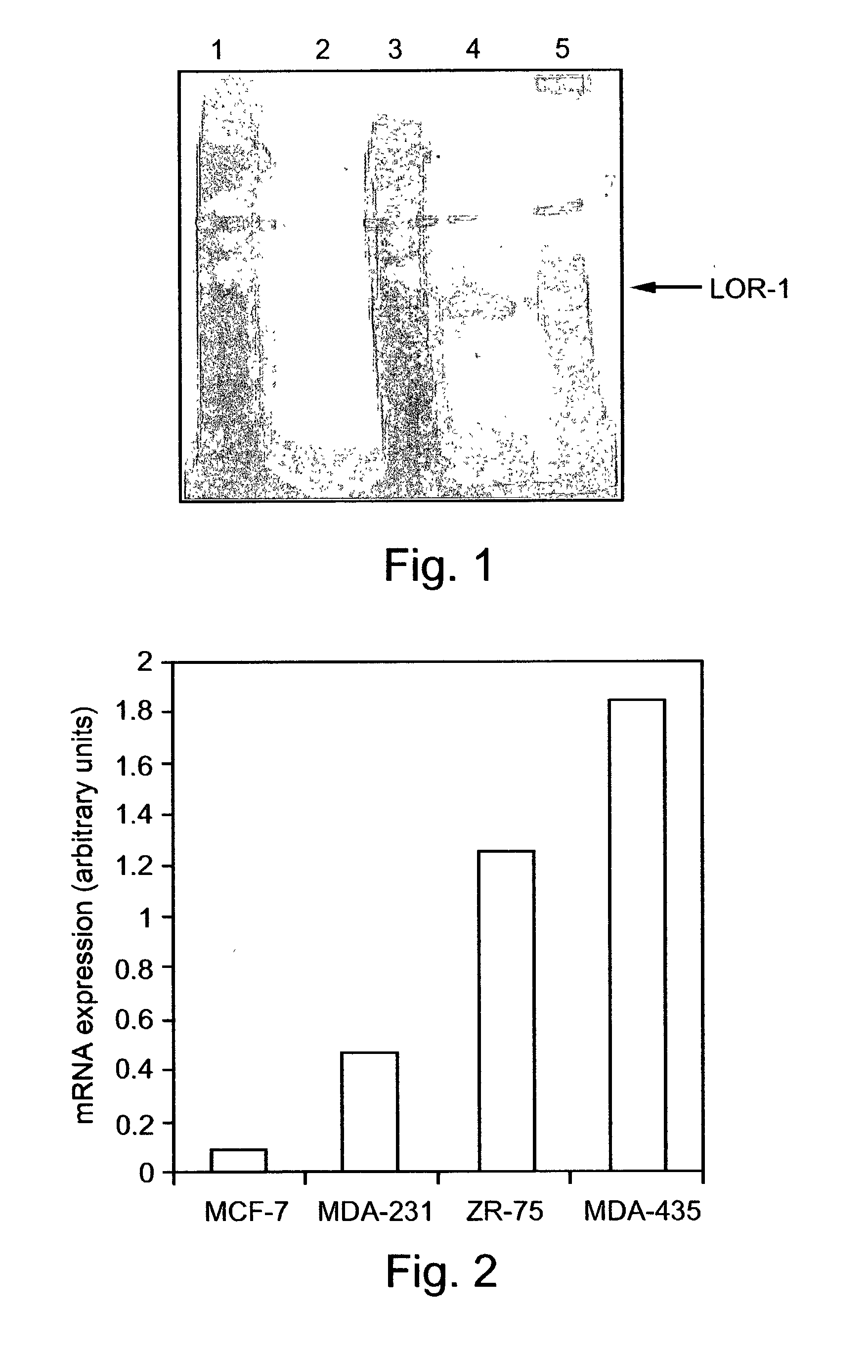Pharmaceutical compositions and methods useful for modulating angiogenesis and inhibiting metastasis and tumor fibrosis