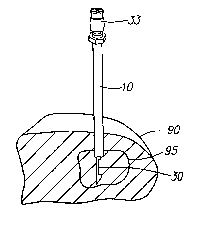 Needle kit and method for microwave ablation, track coagulation, and biopsy