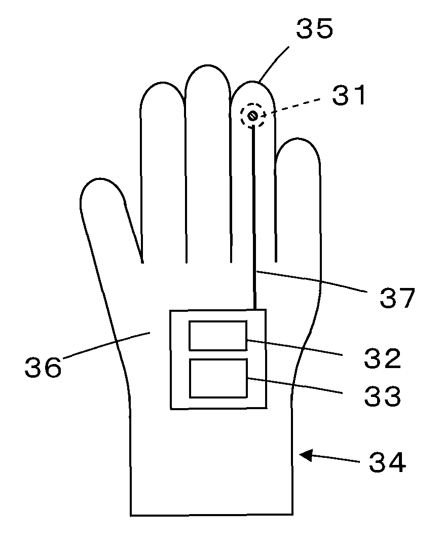 Ultrasound diagnostic apparatus