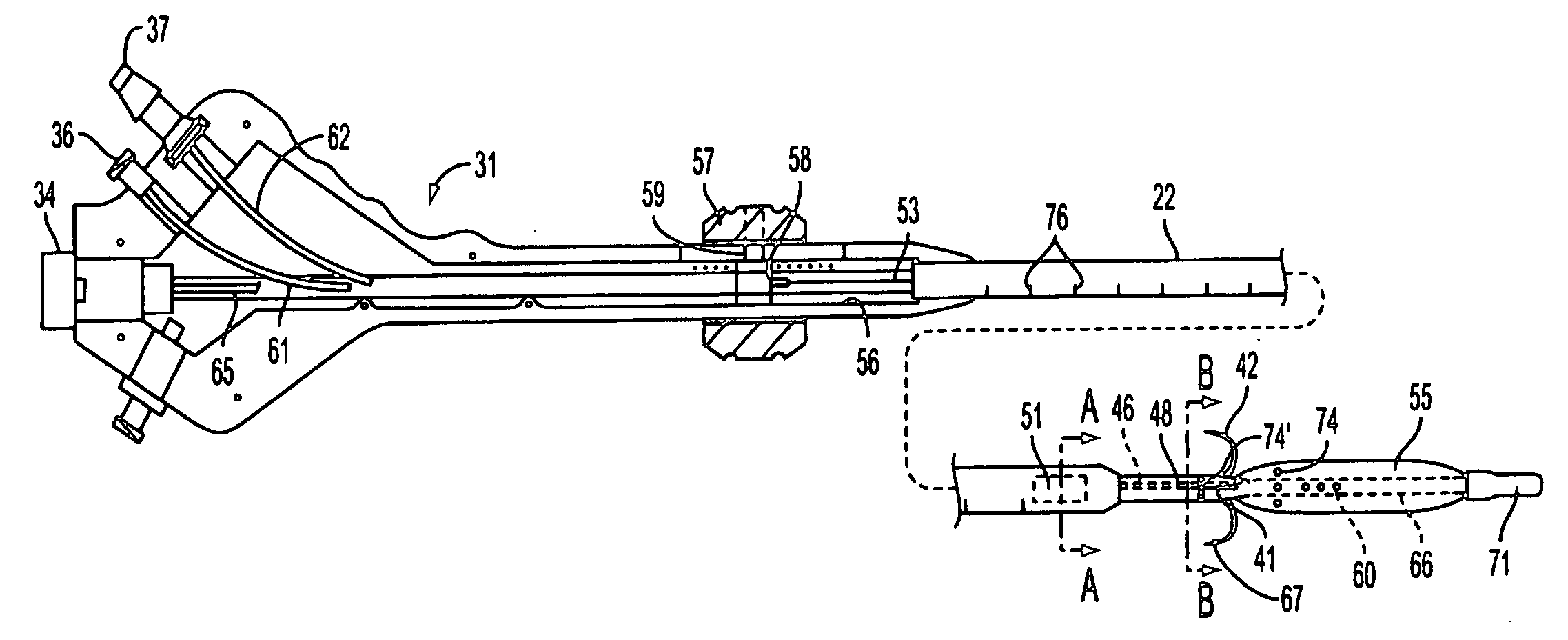 Apparatus and methods for treating female urinary incontinence