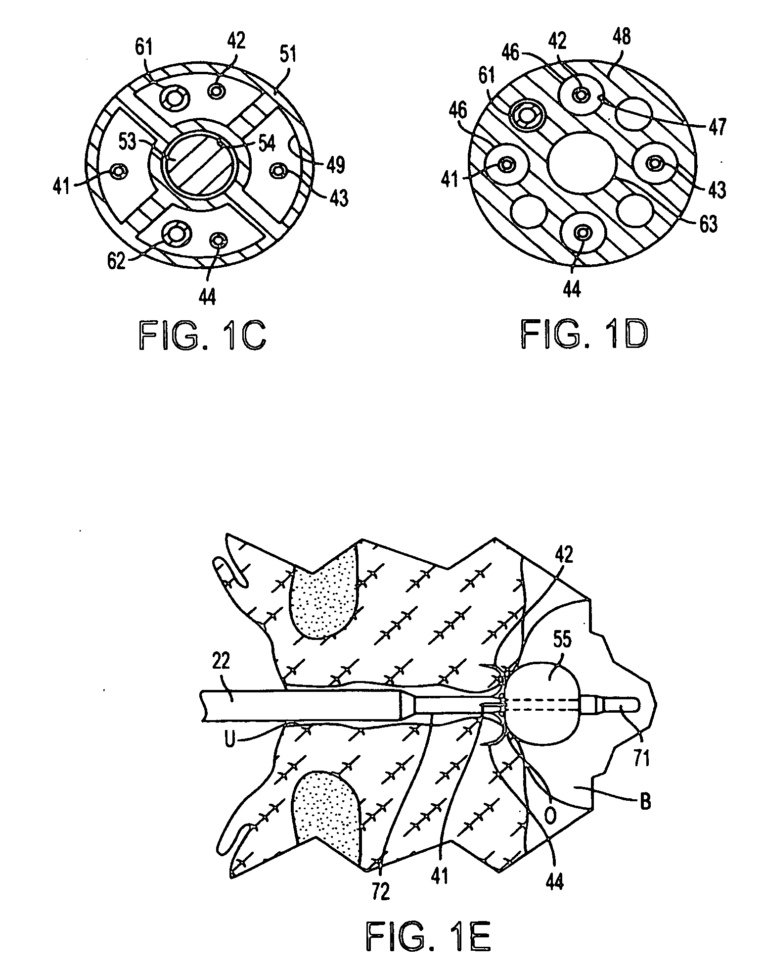 Apparatus and methods for treating female urinary incontinence