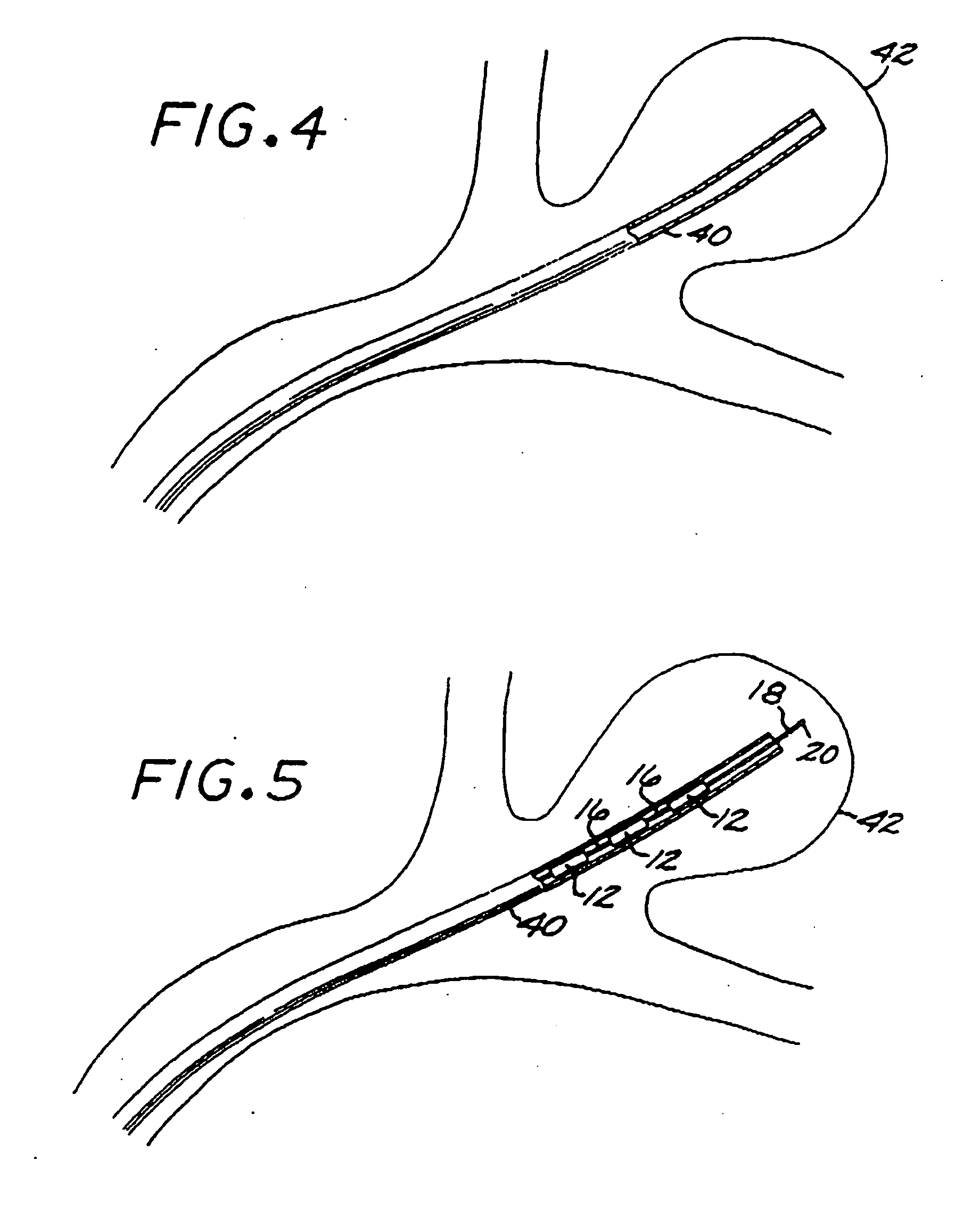 Method of manufacturing expansile filamentous embolization devices