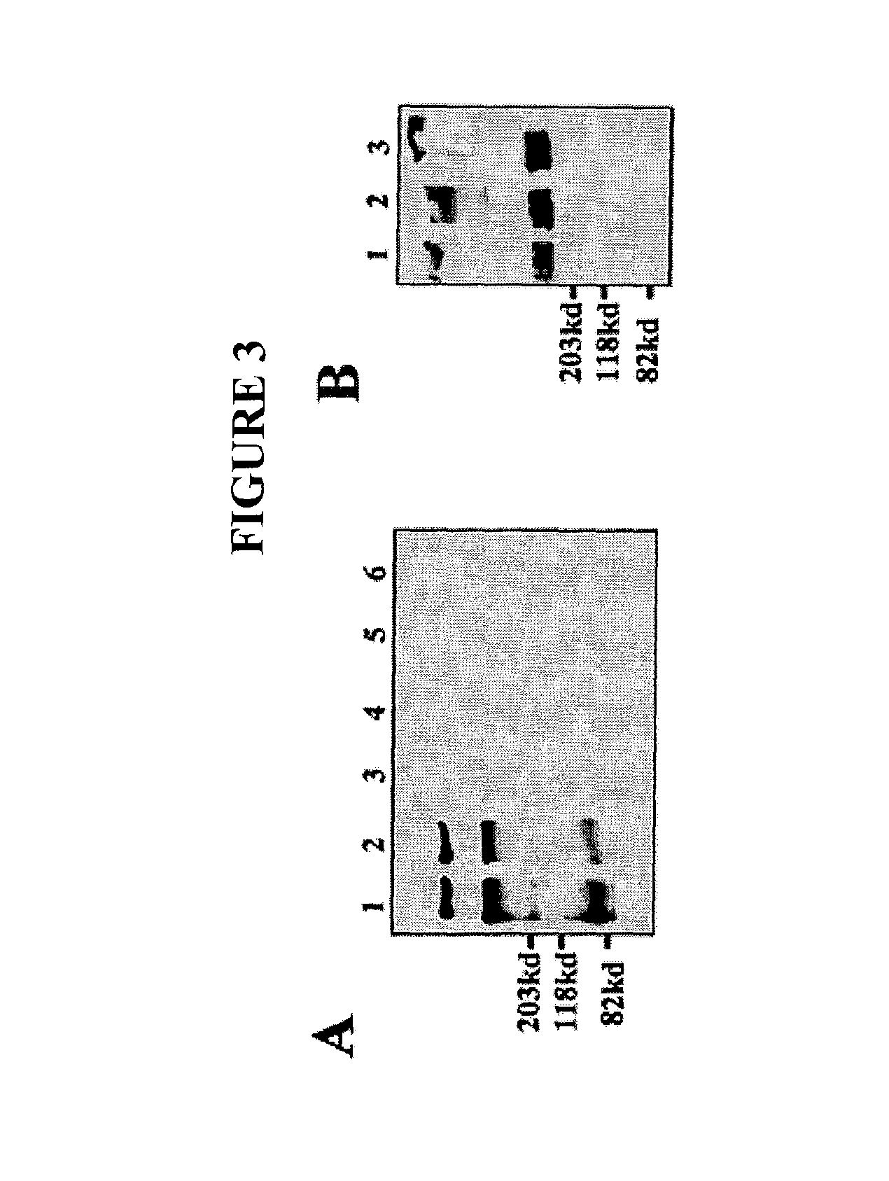 Methods and pharmaceuticals compositions for treating coronary artery disease, ischemia,and vascular disease using angiopoietins