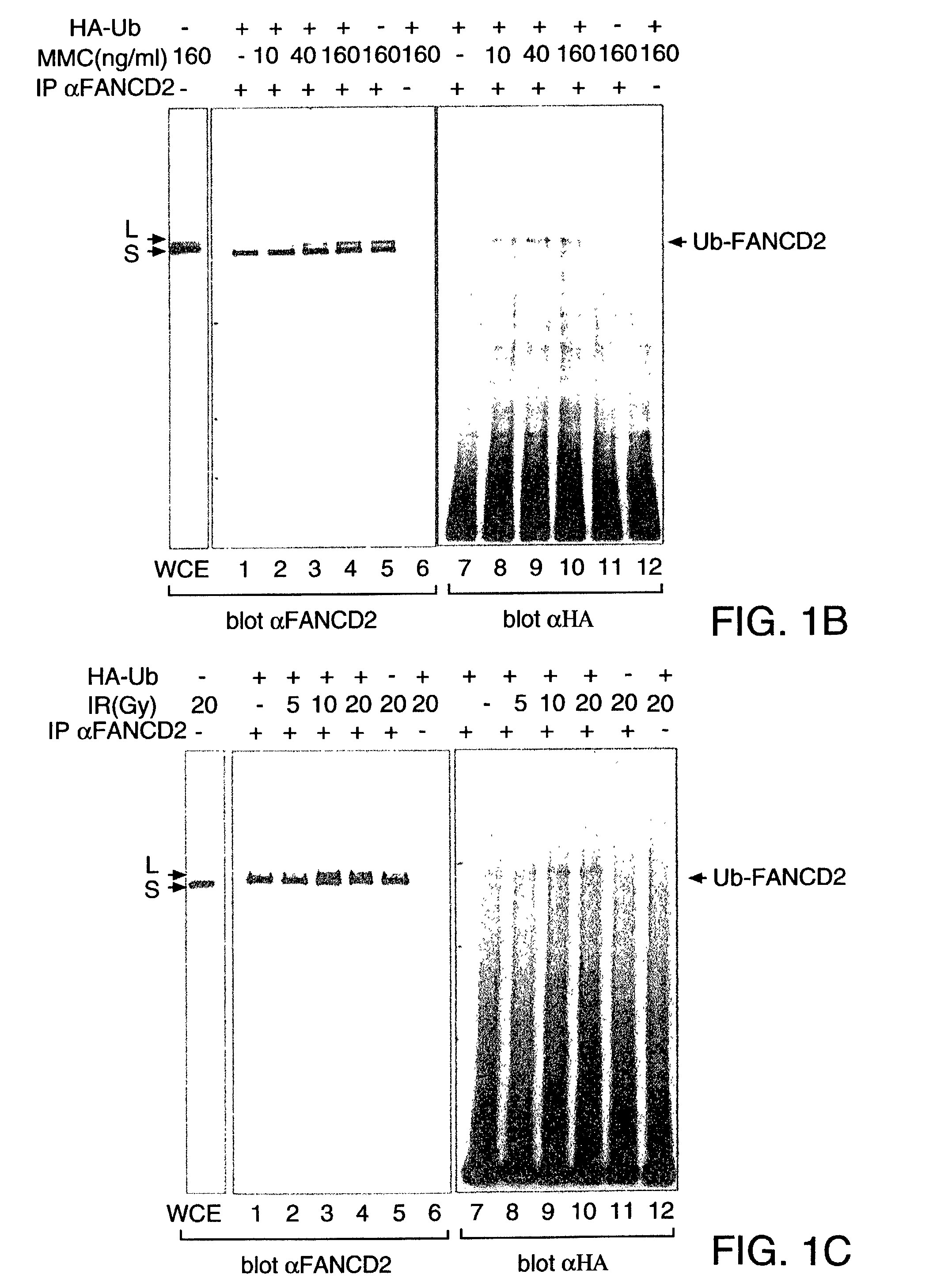 Methods and compositions for the diagnosis of cancer susceptibilities and defective DNA repair mechanisms and treatment thereof