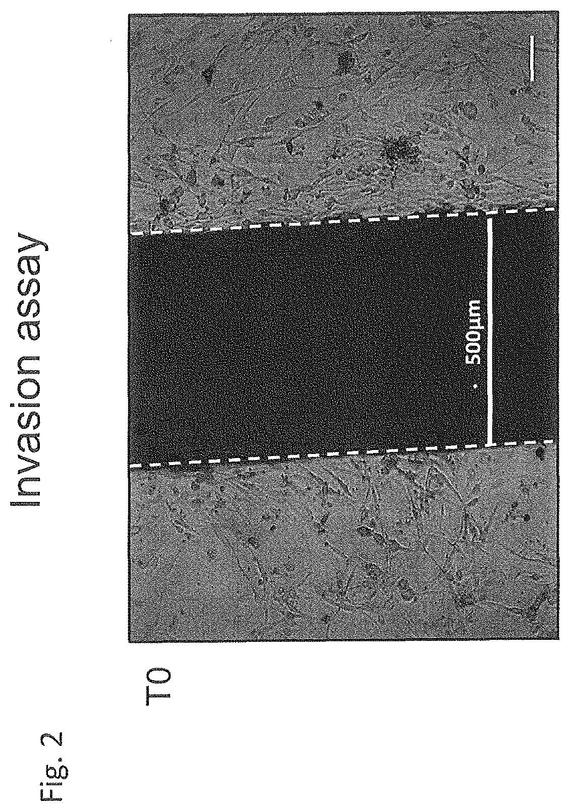 Use of negative functional modulators of erythropoietin for therapy