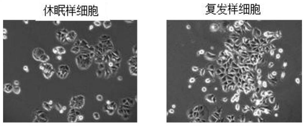 Construction method of dormant or recurrent cell strain induced by tumor endocrine drug