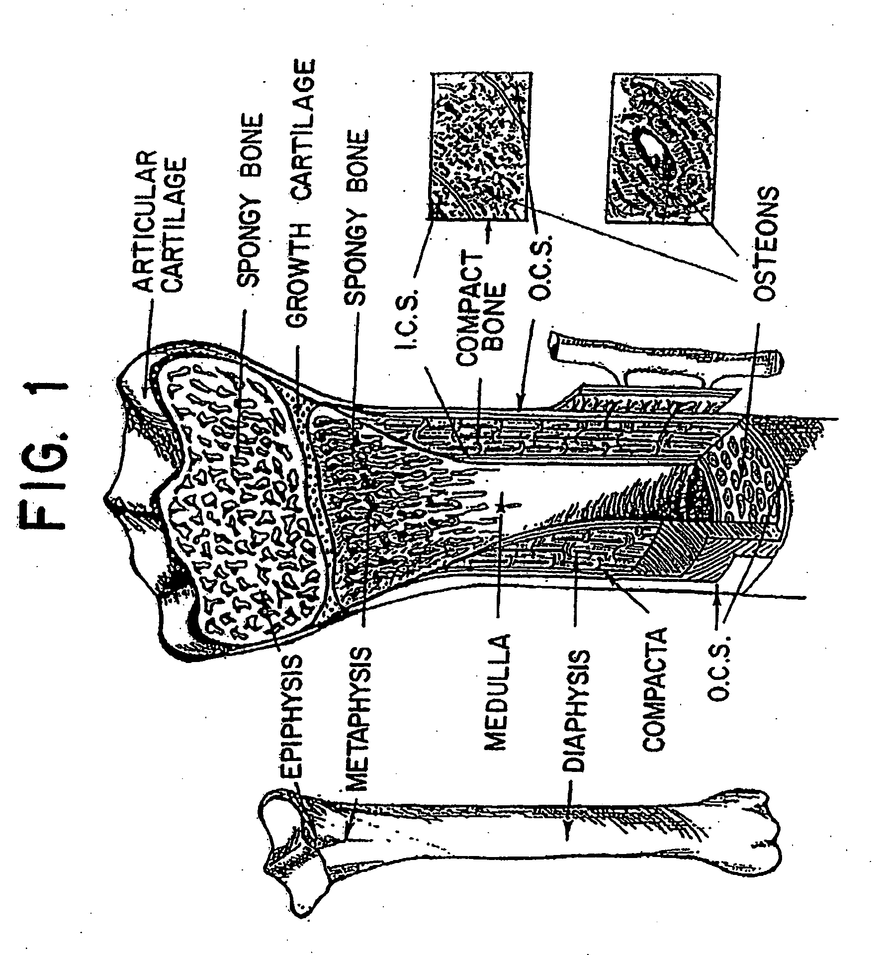 Method and system for modelling bone structure