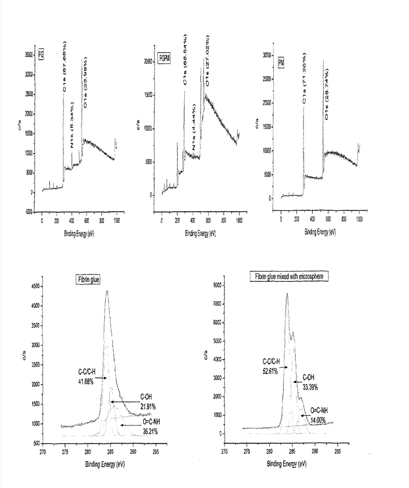 Preparation method and application of fibrin glue composite recombinant human bone morphogenetic protein-2 (rhBMP-2) microsphere