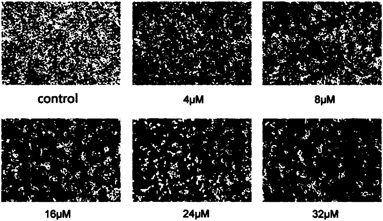 Application of quinoline derivative of N isostere tectoridin in anti-hepatoma drugs