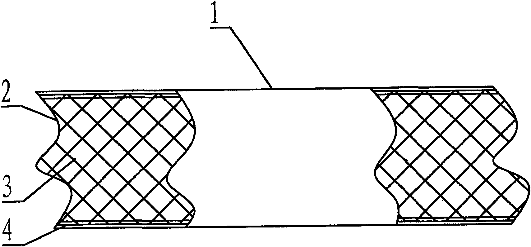 Repairing method for radial tire crown explosion