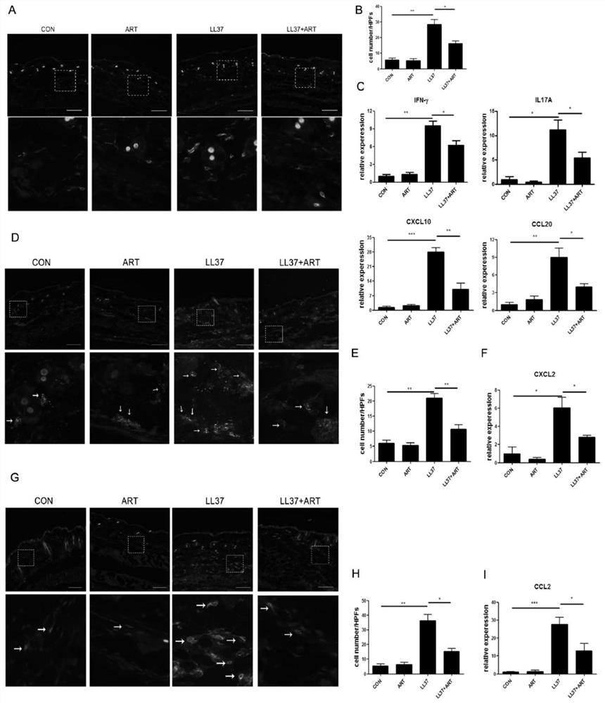 Construction method of animal and cell models for improving rosacea inflammation by artemisinin