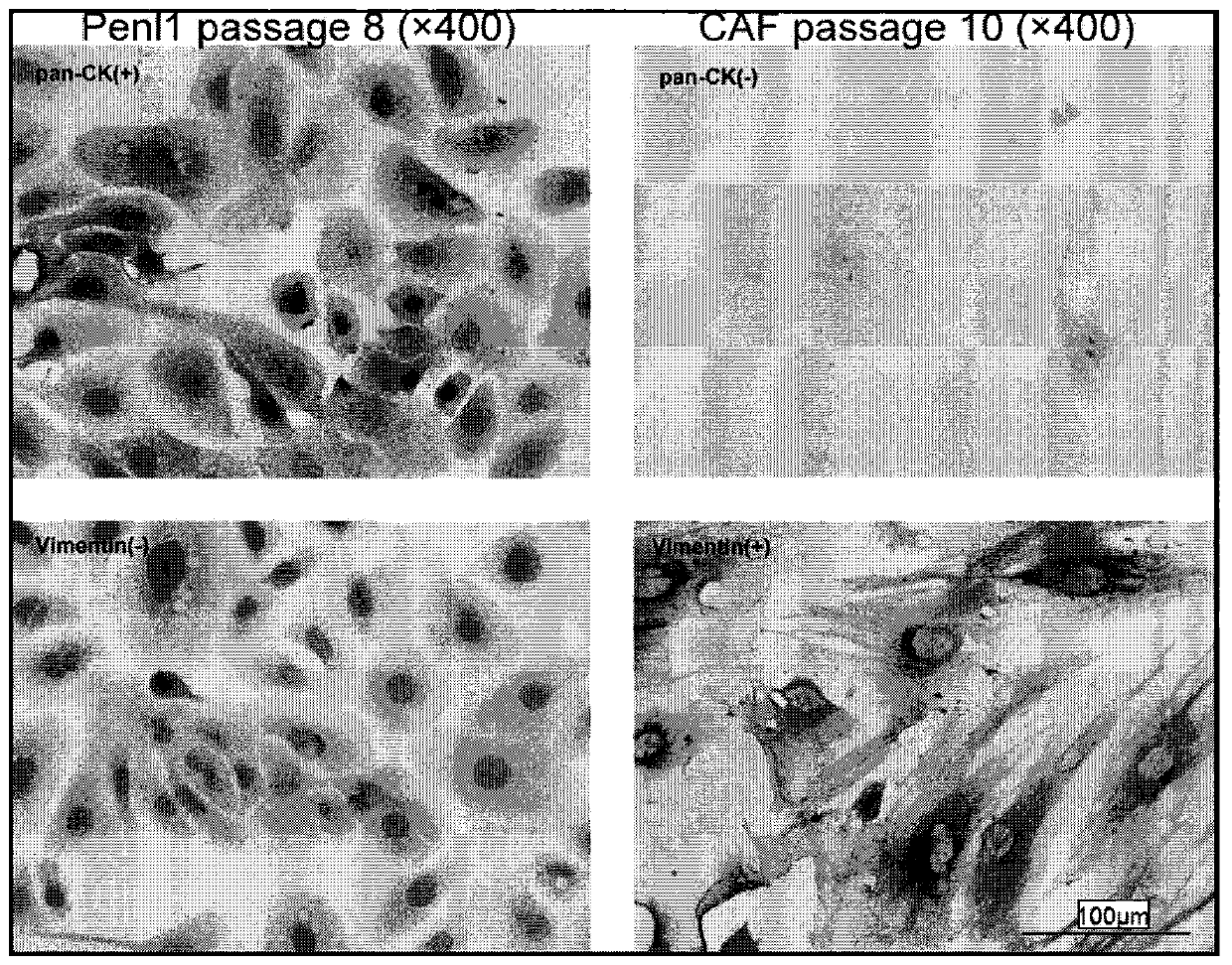 A hpv-negative penile squamous cell carcinoma cell line carrying tp53 mutation and its use