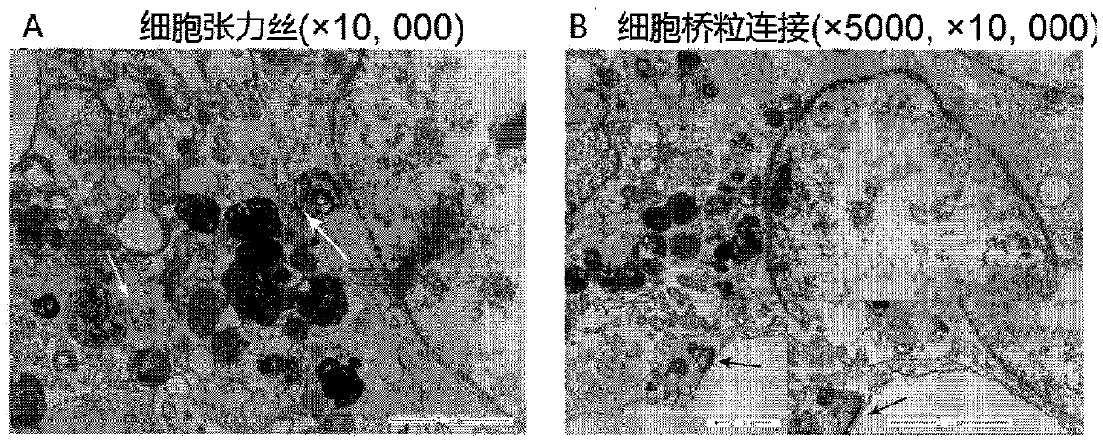 A hpv-negative penile squamous cell carcinoma cell line carrying tp53 mutation and its use