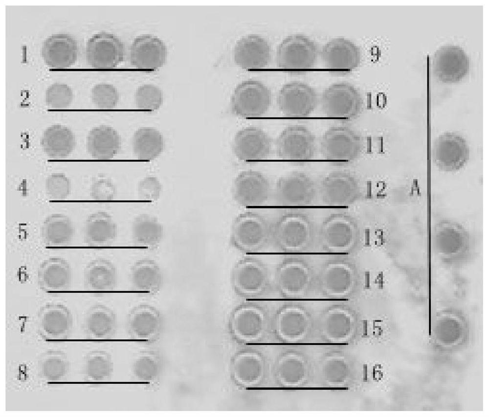 Probe, gene chip and kit for detecting genes related to sudden exercise death