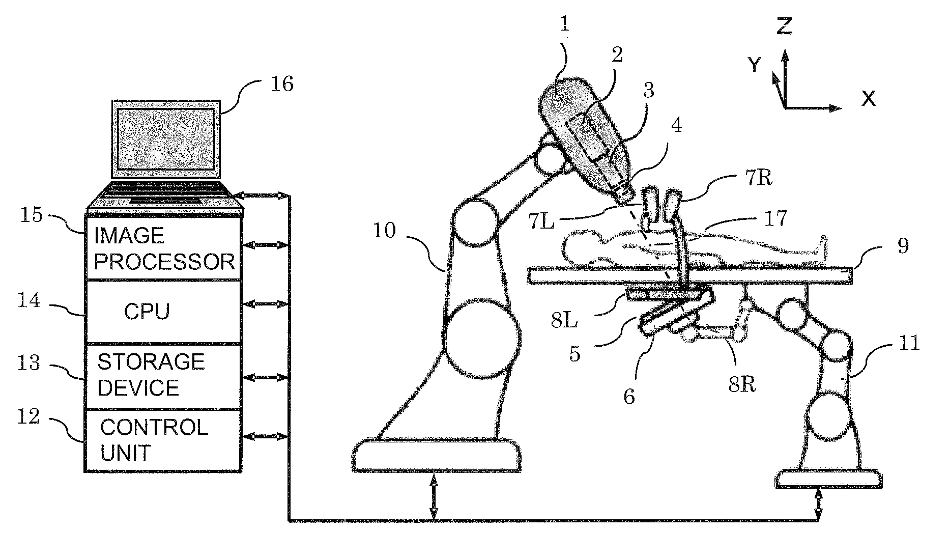 Real-time three-dimensional radiation therapy apparatus and method