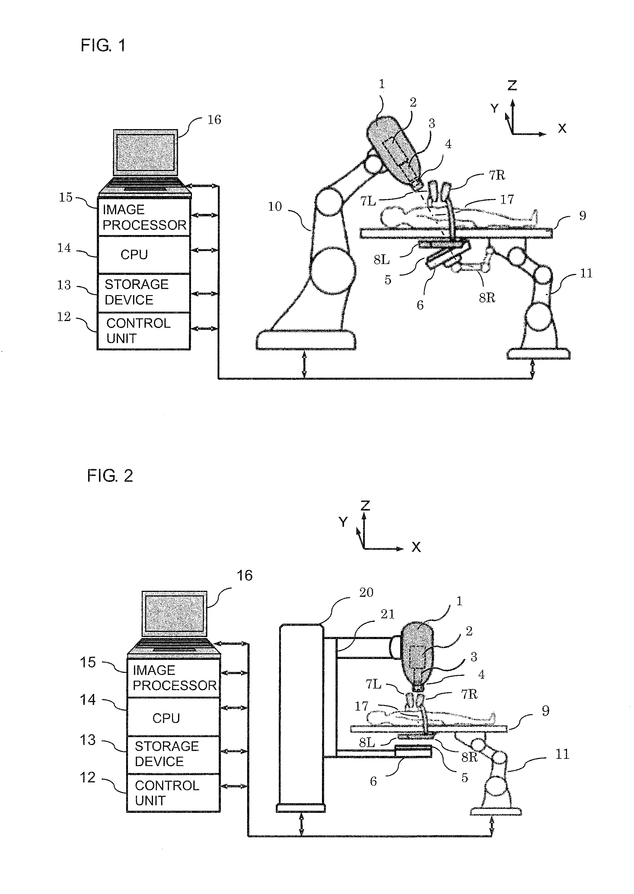Real-time three-dimensional radiation therapy apparatus and method