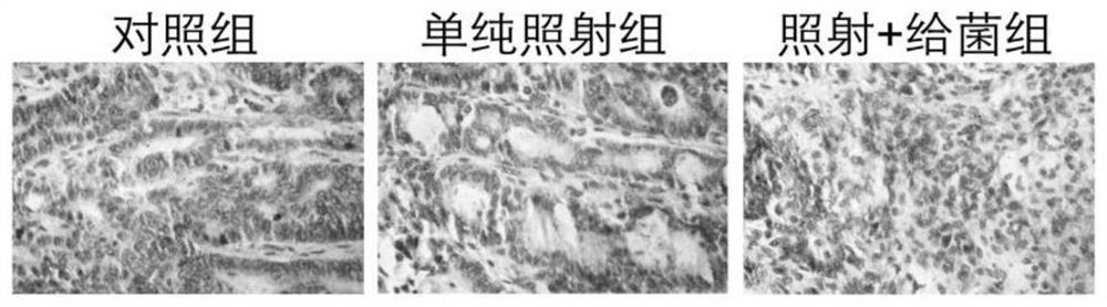 Application of intestinal Rosebariella in preparation of tumor radiosensitizer
