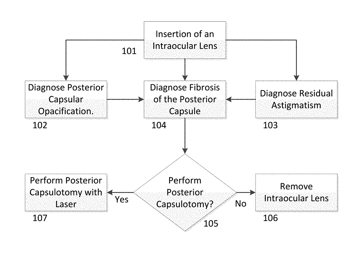 Apparatus for round posterior capsulotomy for the opacification of a posterior capsule and lens