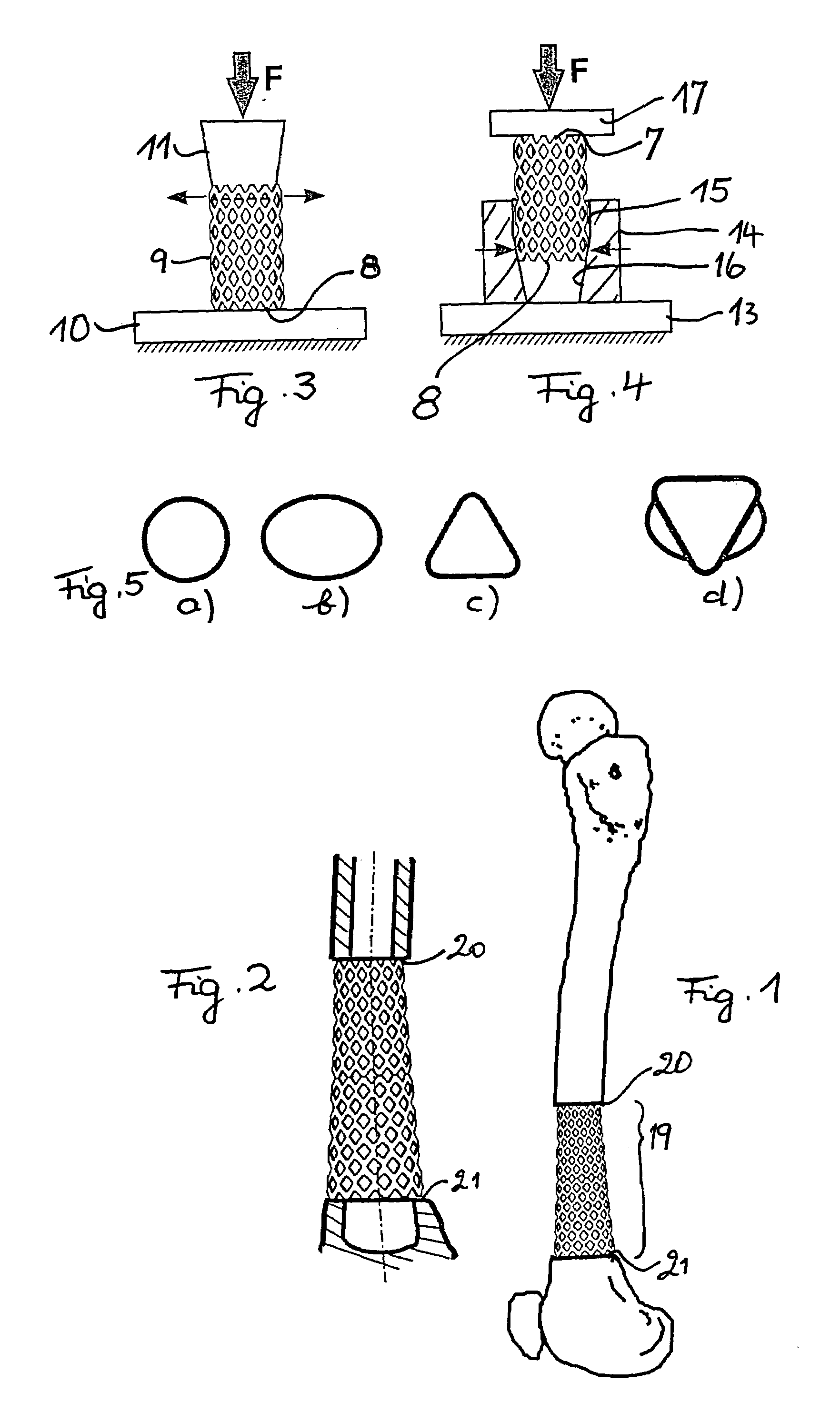 Method for the manufacture of a tubular spacer and spacer