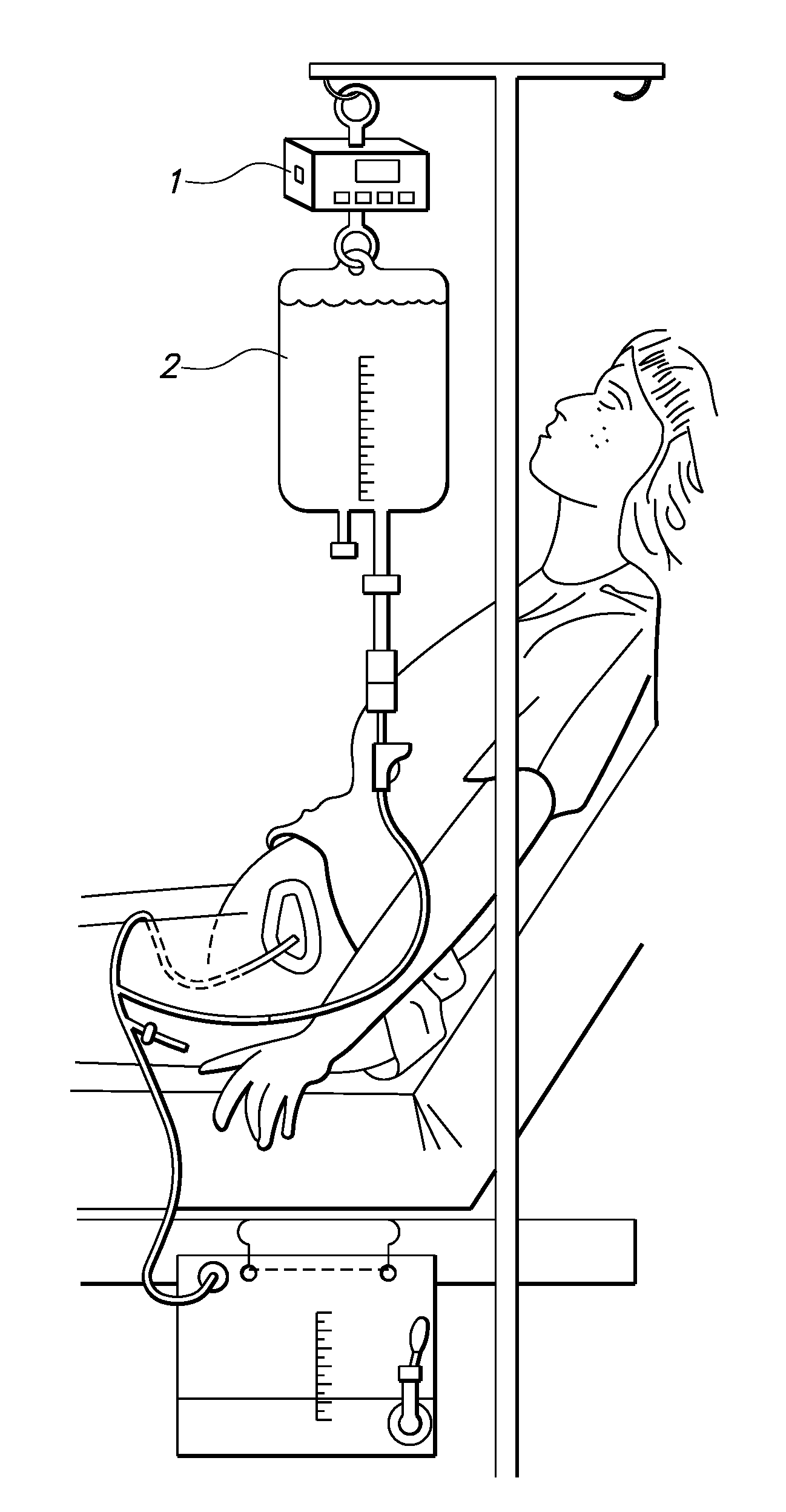 Continuous bladder irrigation alarm