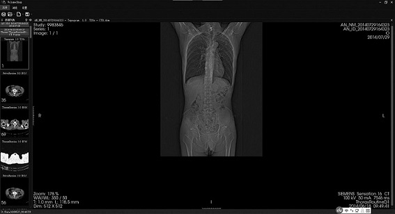 A method for parsing dicom files in a file directory