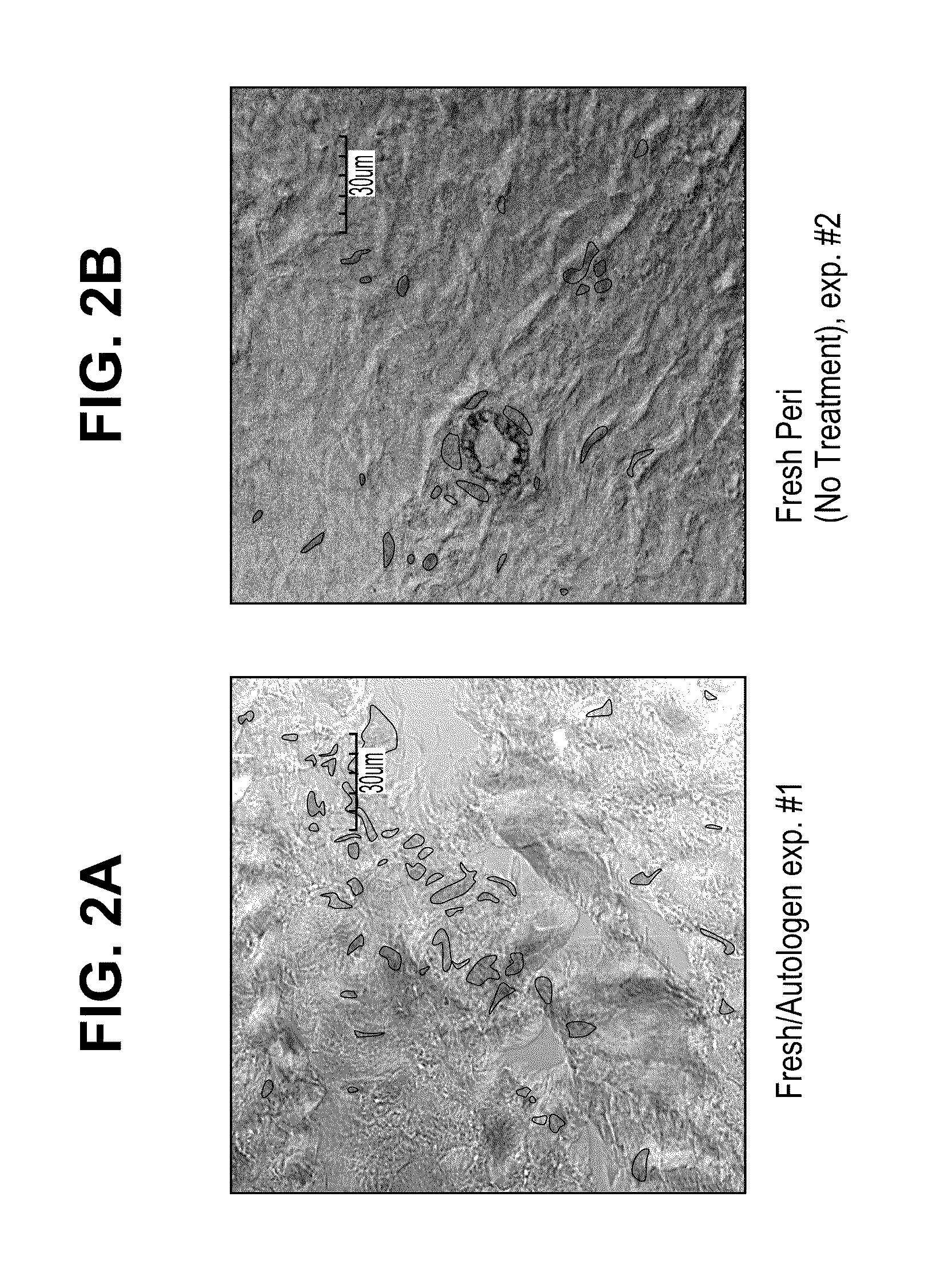 Methods for stabilizing a bioprosthetic tissue by chemical modification of antigenic carbohydrates