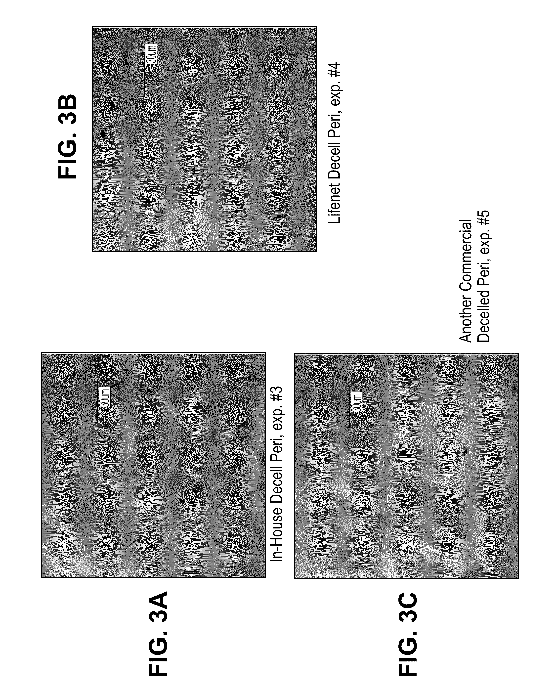 Methods for stabilizing a bioprosthetic tissue by chemical modification of antigenic carbohydrates