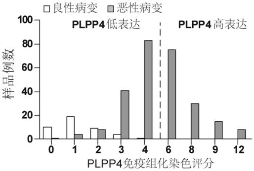 Application of plpp4 as a target for diagnosis, treatment and prognosis of non-small cell lung cancer