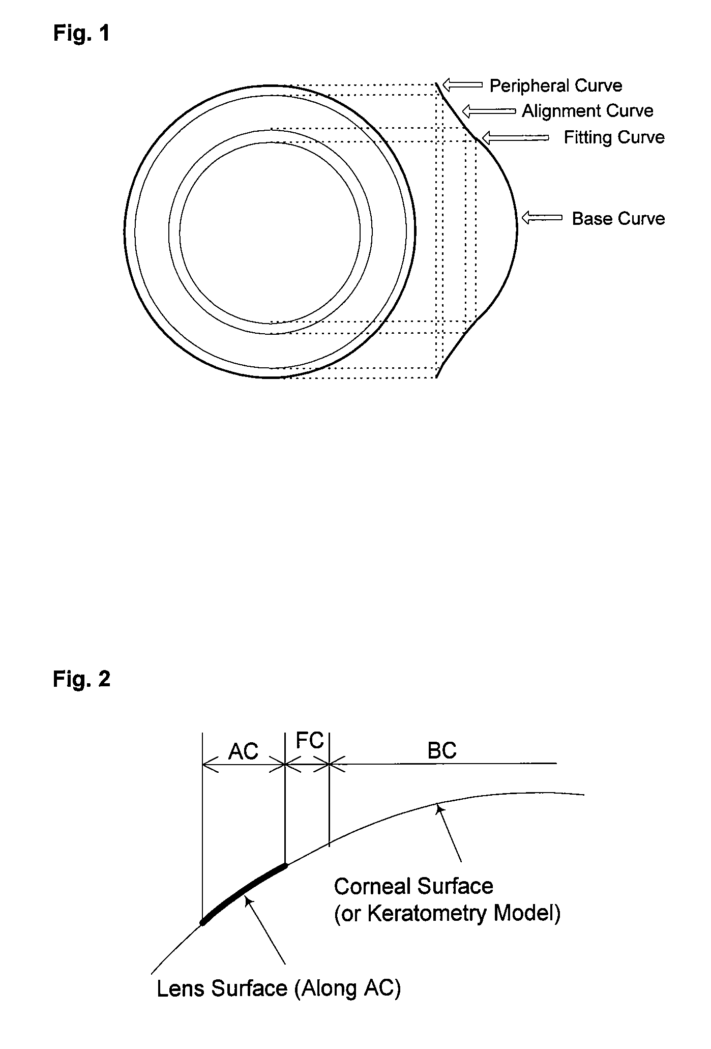 Orthokeratology lens wear combined with chemical treatment to correct myopia, hyperopia or astigmatism