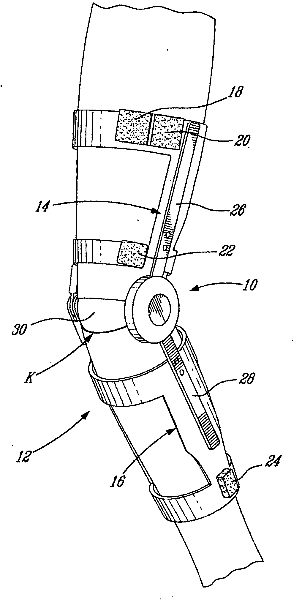 High Torque Active Mechanism for Orthotic and/or Prosthetic Devices