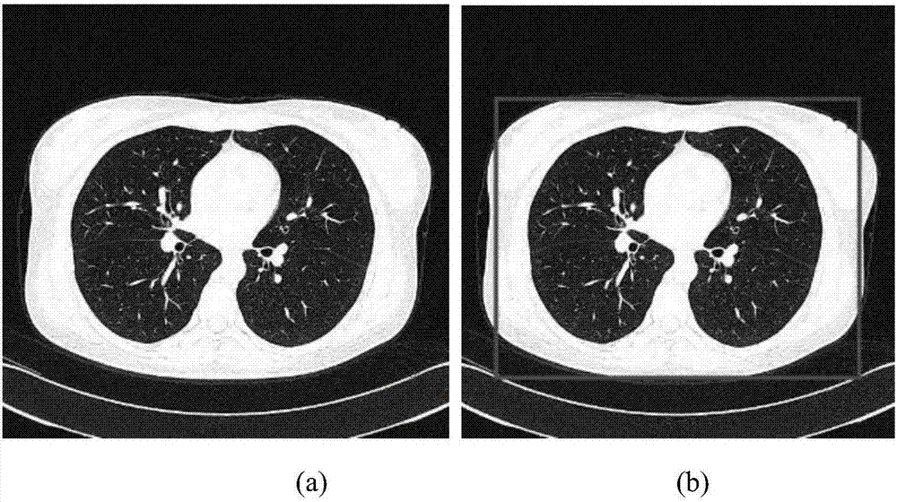 Pulmonary nodule feature extraction method based on convolutional neural network and principal component analysis