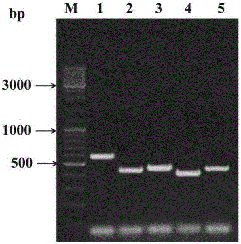 Verticillium dahliae oligosaccharyl transferase target gene fragment and interference vector and application thereof