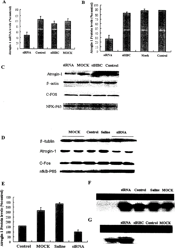 Interference RNA interfering muscle specific E3 ubiquitin protein ligase gene, vector containing same and application thereof