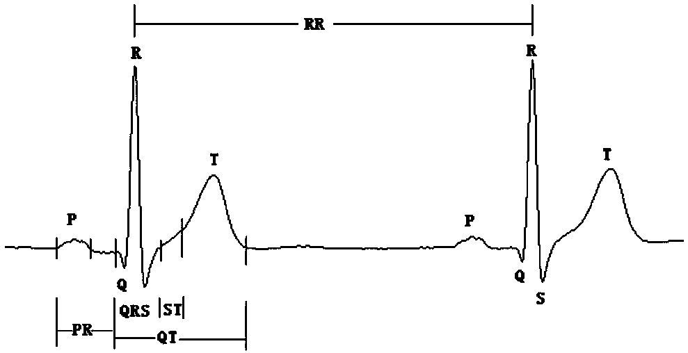 Electrocardiosignal quality identification method and electrocardiogram analysis method