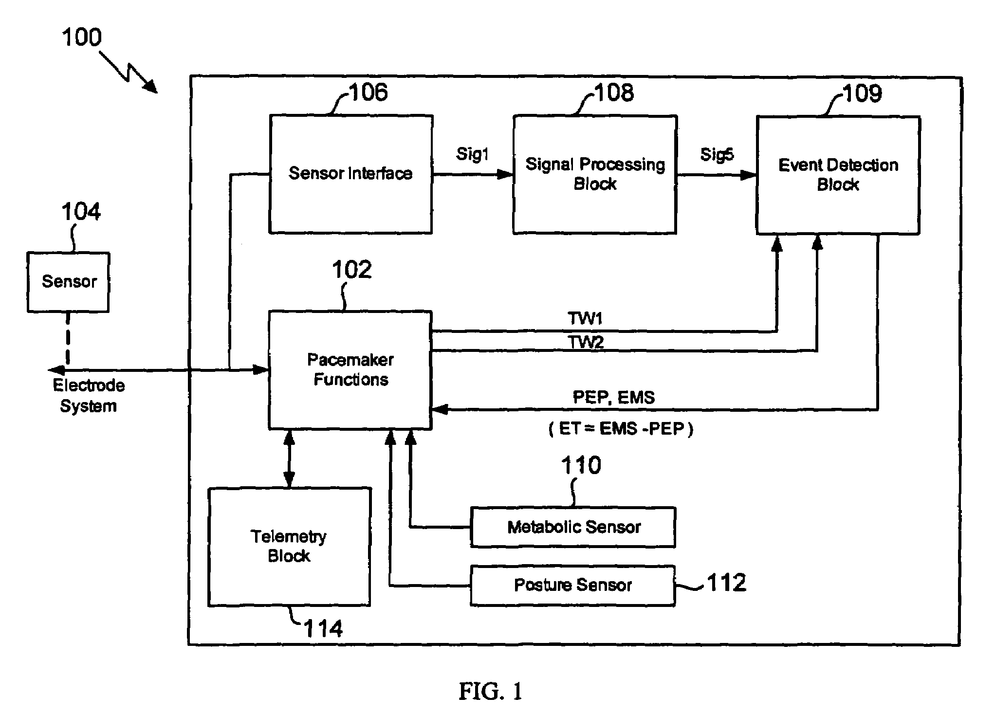 Method for extracting timing parameters using a cardio-mechanical sensor