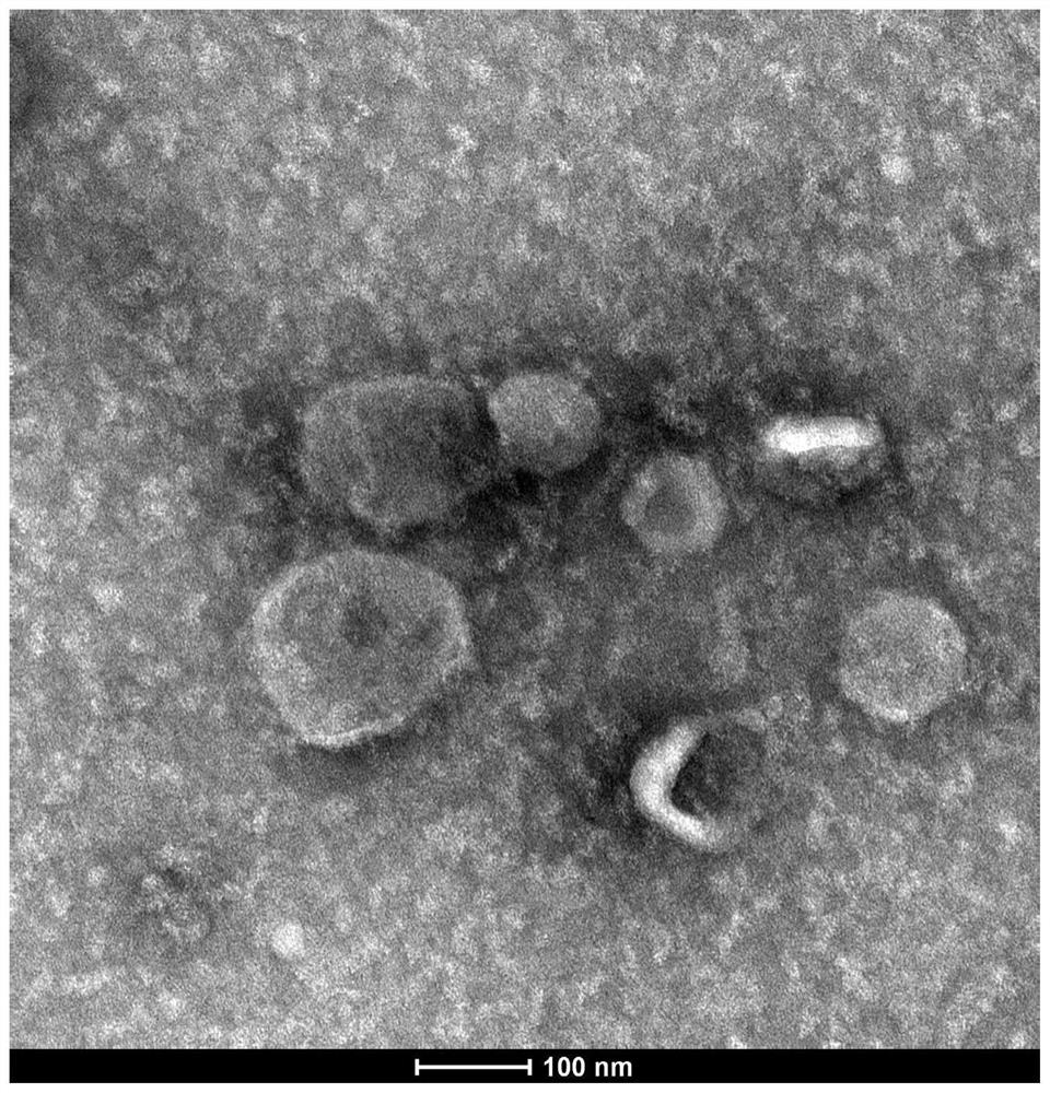 Method for rapidly extracting exosome in plasma and extraction reagent