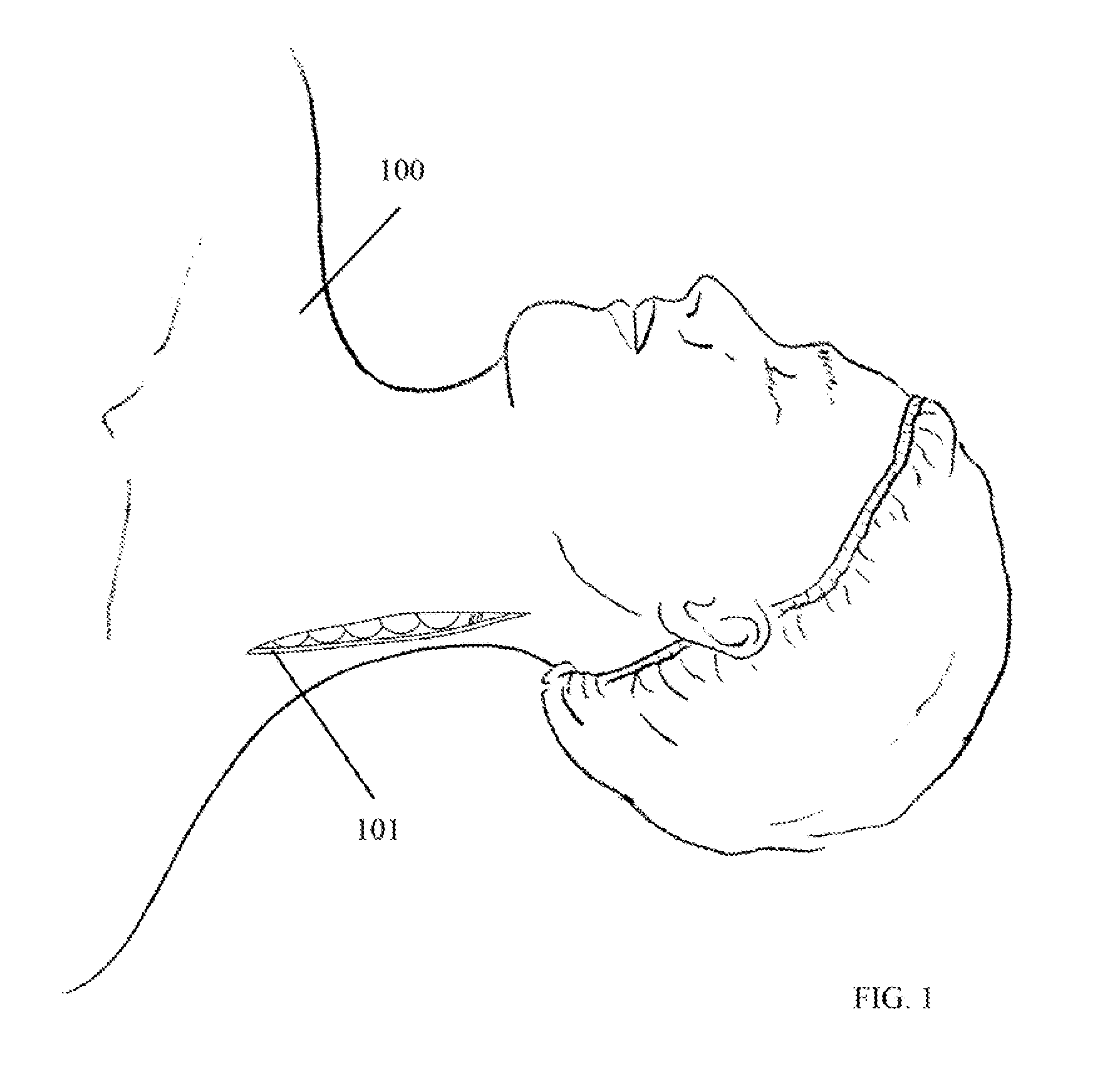 Method of lateral facet approach, decompression and fusion using screws and staples as well as arthroplasty