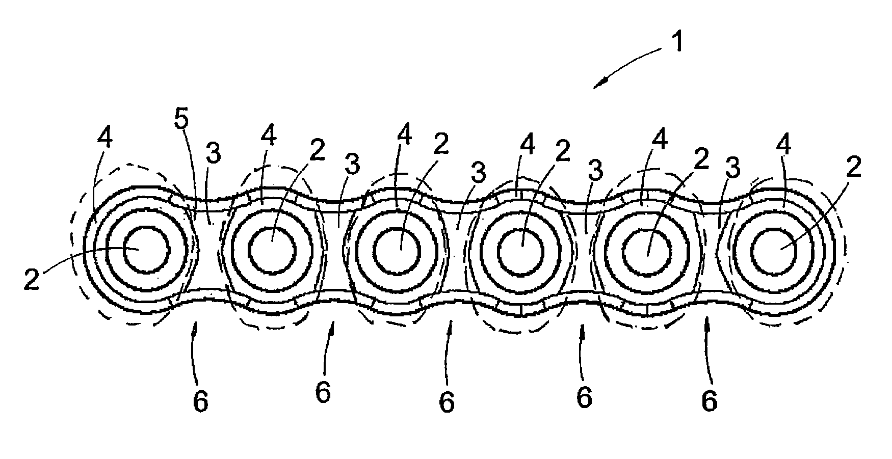 Surgical implant and manufacturing method