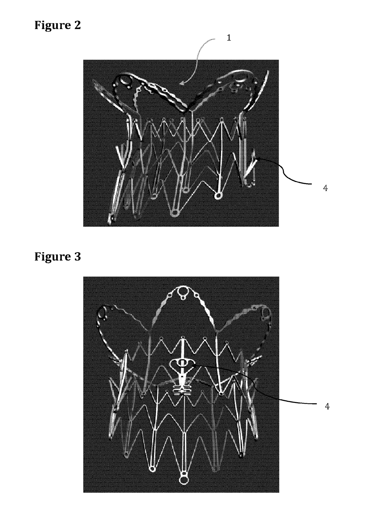 Atrio-Ventricular Valve Stent with Native Leaflet Grasping and Holding Mechanism