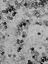 Cancer pathologic evolution early-stage GPR116 gene mRNA level in-situ hybridization detection kit, detection method and applications thereof