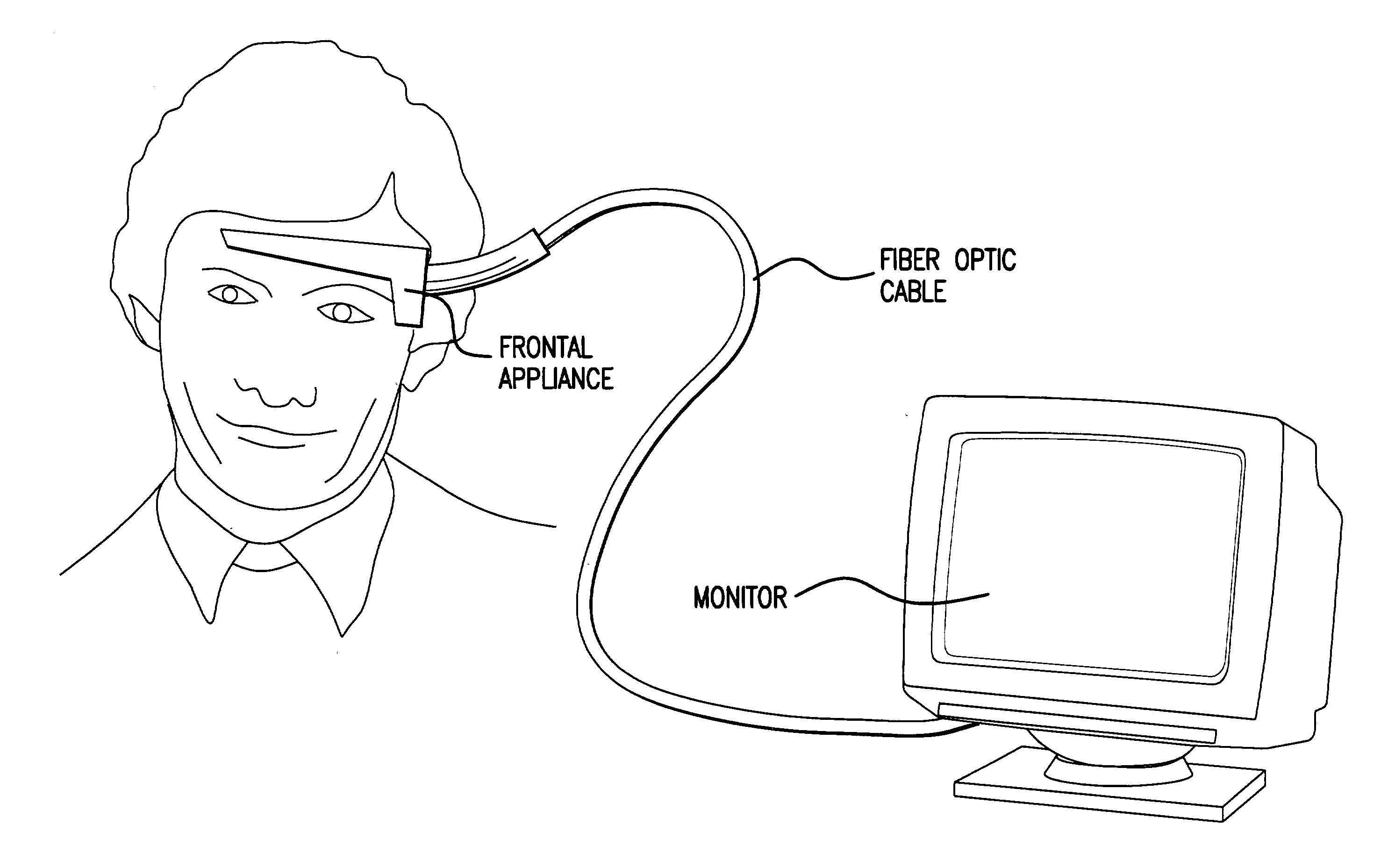 Fiber optic power source for an electroencephalograph acquisition apparatus
